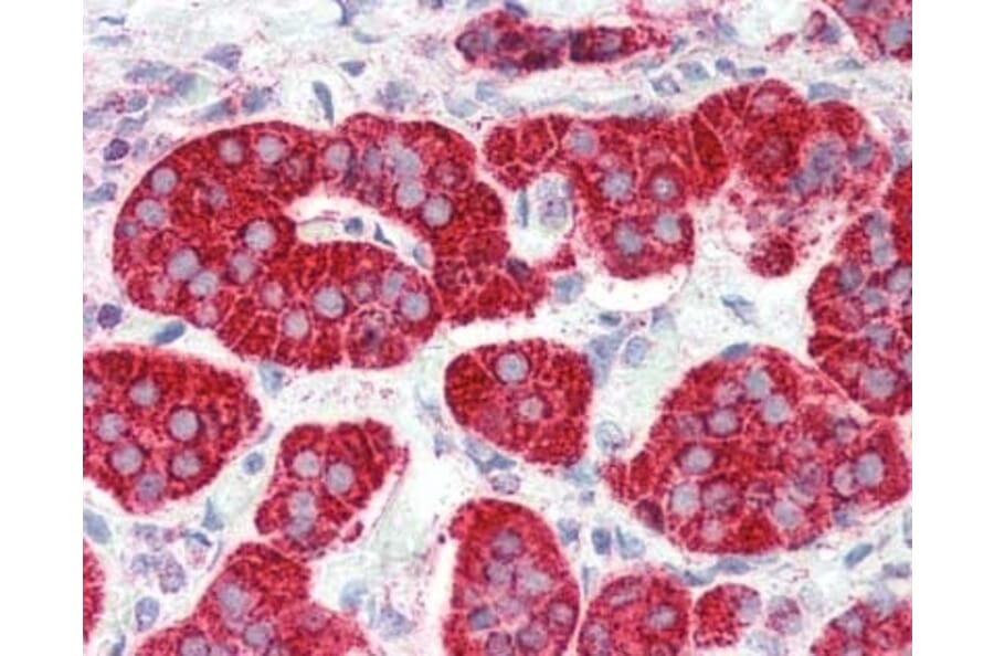 Immunohistochemistry - Anti-CRTH2 Antibody (A283294) - Antibodies.com