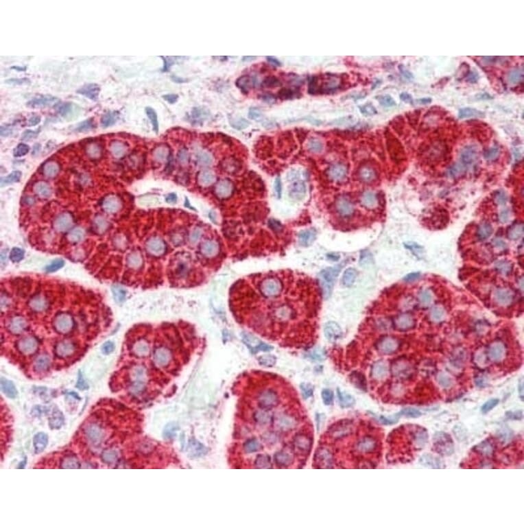 Immunohistochemistry - Anti-CRTH2 Antibody (A283294) - Antibodies.com