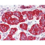 Immunohistochemistry - Anti-CRTH2 Antibody (A283294) - Antibodies.com