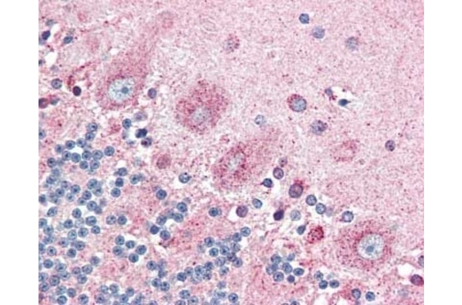 Immunohistochemistry - Anti-CRTH2 Antibody (A283294) - Antibodies.com