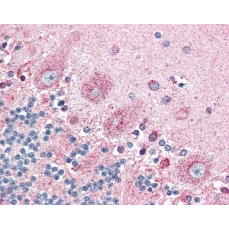 Immunohistochemistry - Anti-CRTH2 Antibody (A283294) - Antibodies.com
