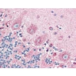 Immunohistochemistry - Anti-CRTH2 Antibody (A283294) - Antibodies.com