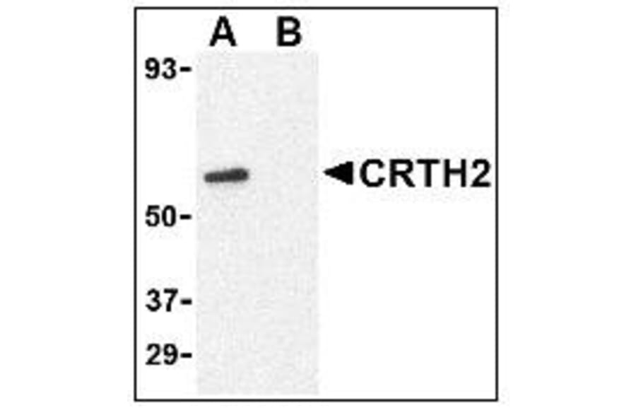 Western Blot - Anti-CRTH2 Antibody (A283294) - Antibodies.com