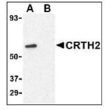 Western Blot - Anti-CRTH2 Antibody (A283294) - Antibodies.com