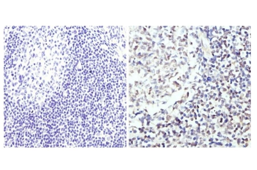 Immunohistochemistry - Anti-GATA3 Antibody (A283413) - Antibodies.com