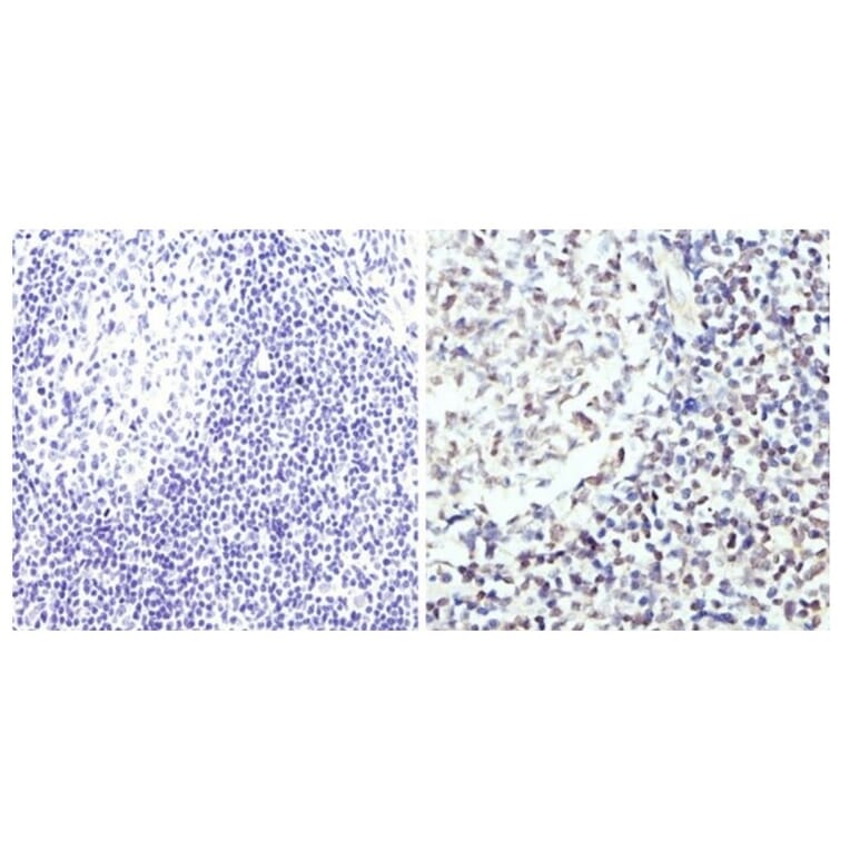 Immunohistochemistry - Anti-GATA3 Antibody (A283413) - Antibodies.com