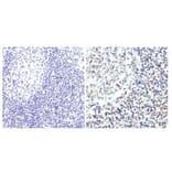 Immunohistochemistry - Anti-GATA3 Antibody (A283413) - Antibodies.com