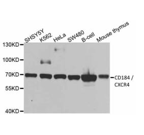 Western Blot - Anti-CXCR4 Antibody (A283457) - Antibodies.com
