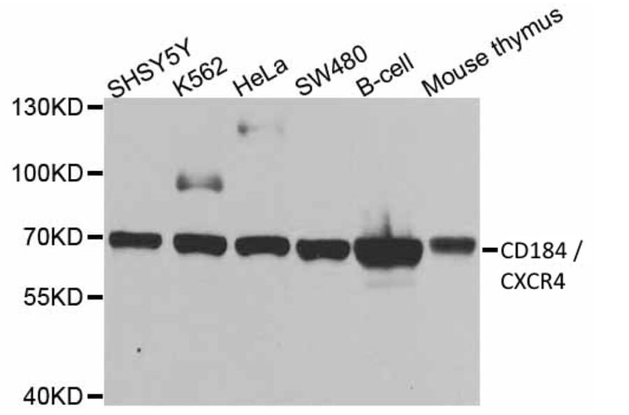 Western Blot - Anti-CXCR4 Antibody (A283457) - Antibodies.com