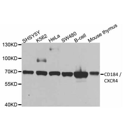 Western Blot - Anti-CXCR4 Antibody (A283457) - Antibodies.com