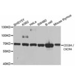 Western Blot - Anti-CXCR4 Antibody (A283457) - Antibodies.com