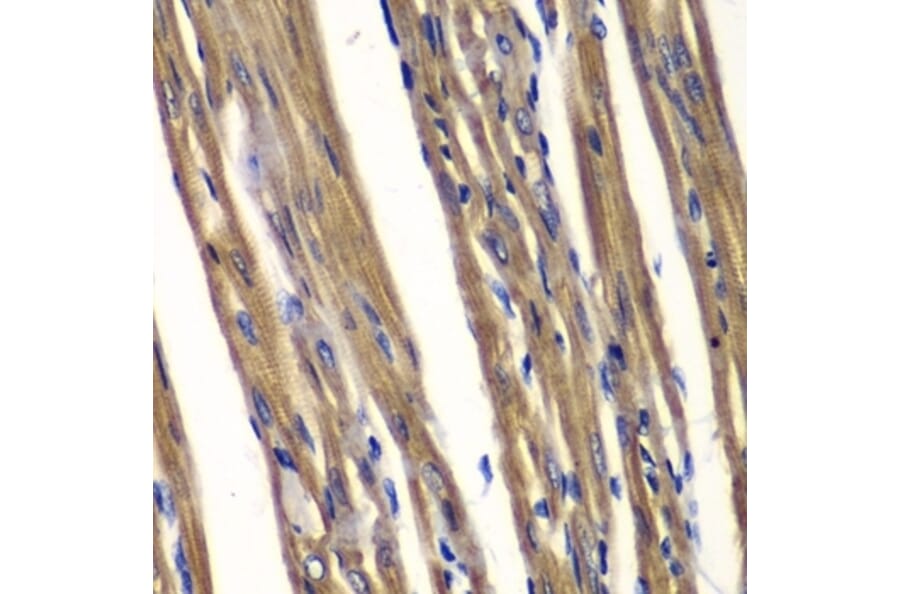 Immunohistochemistry - Anti-TCPTP Antibody (A283521) - Antibodies.com