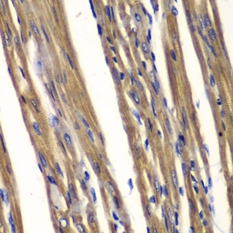 Immunohistochemistry - Anti-TCPTP Antibody (A283521) - Antibodies.com