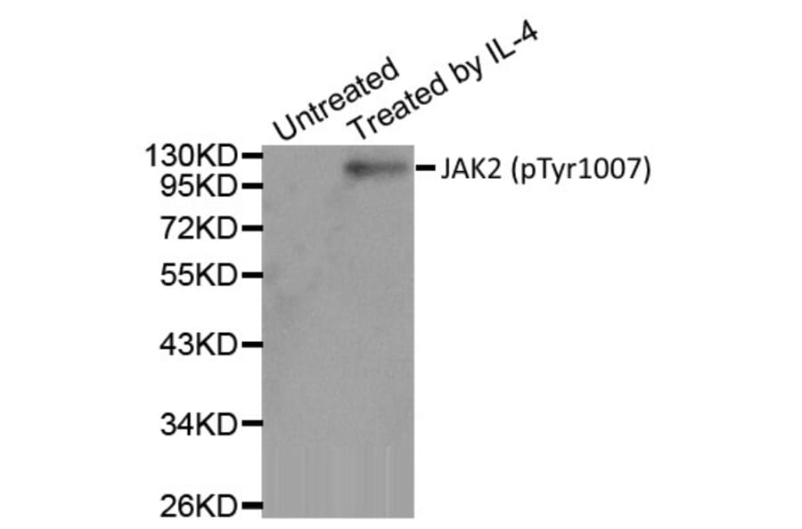 Western Blot - Anti-JAK2 (phospho Tyr1007) Antibody (A283637) - Antibodies.com