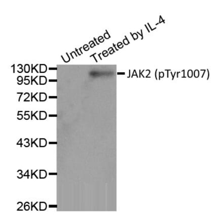 Western Blot - Anti-JAK2 (phospho Tyr1007) Antibody (A283637) - Antibodies.com