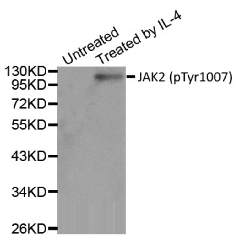 Western Blot - Anti-JAK2 (phospho Tyr1007) Antibody (A283637) - Antibodies.com