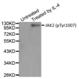 Western Blot - Anti-JAK2 (phospho Tyr1007) Antibody (A283637) - Antibodies.com