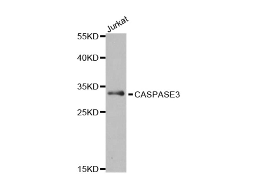 Western Blot - Anti-Caspase-3 Antibody (A283703) - Antibodies.com