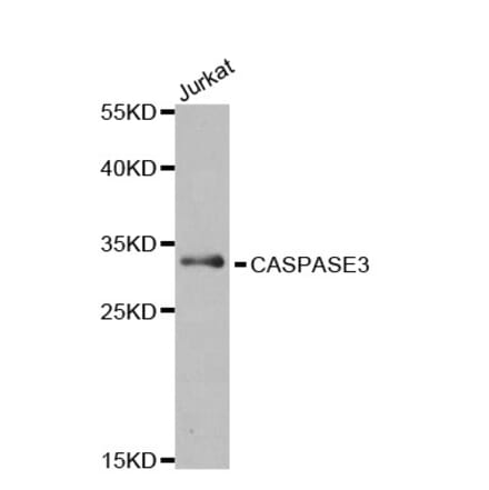 Western Blot - Anti-Caspase-3 Antibody (A283703) - Antibodies.com