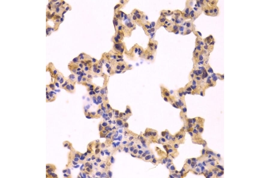Immunohistochemistry - Anti-Caspase-3 Antibody (A283703) - Antibodies.com
