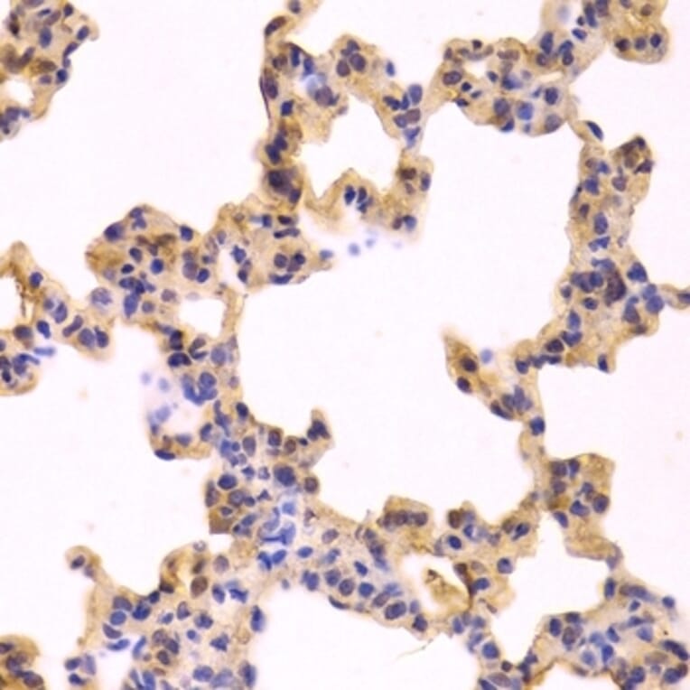 Immunohistochemistry - Anti-Caspase-3 Antibody (A283703) - Antibodies.com