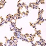 Immunohistochemistry - Anti-Caspase-3 Antibody (A283703) - Antibodies.com