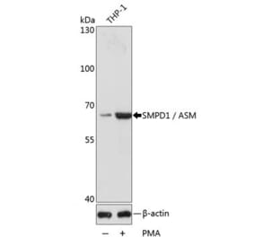 Western Blot - Anti-Acid Sphingomyelinase Antibody (A283812) - Antibodies.com