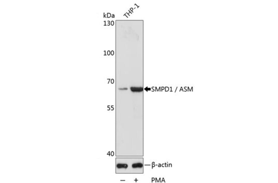Western Blot - Anti-Acid Sphingomyelinase Antibody (A283812) - Antibodies.com