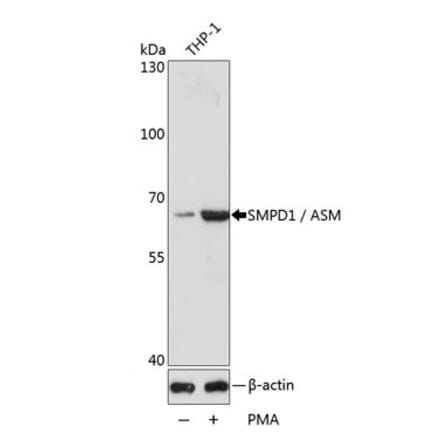 Western Blot - Anti-Acid Sphingomyelinase Antibody (A283812) - Antibodies.com