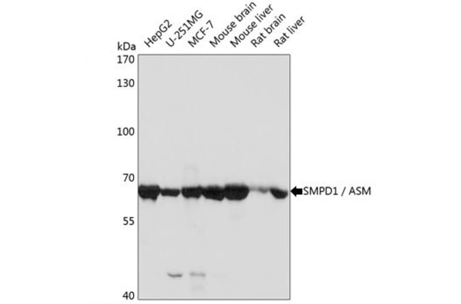 Western Blot - Anti-Acid Sphingomyelinase Antibody (A283812) - Antibodies.com