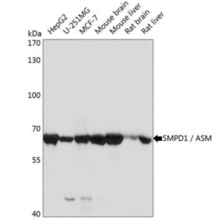 Western Blot - Anti-Acid Sphingomyelinase Antibody (A283812) - Antibodies.com