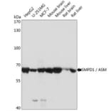 Western Blot - Anti-Acid Sphingomyelinase Antibody (A283812) - Antibodies.com
