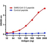 ELISA - Anti-SARS-CoV-2 Envelope Protein Antibody (A283824) - Antibodies.com