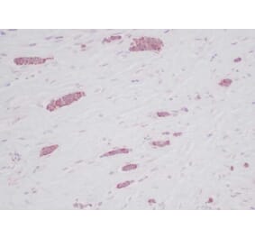 Immunohistochemistry - Anti-RANTES Antibody - BSA and Azide free (A283833) - Antibodies.com