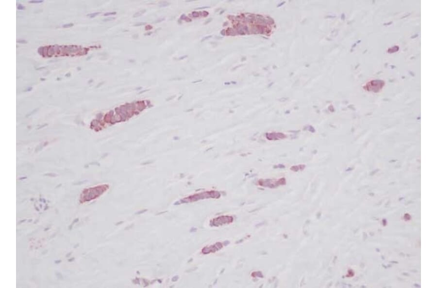 Immunohistochemistry - Anti-RANTES Antibody - BSA and Azide free (A283833) - Antibodies.com