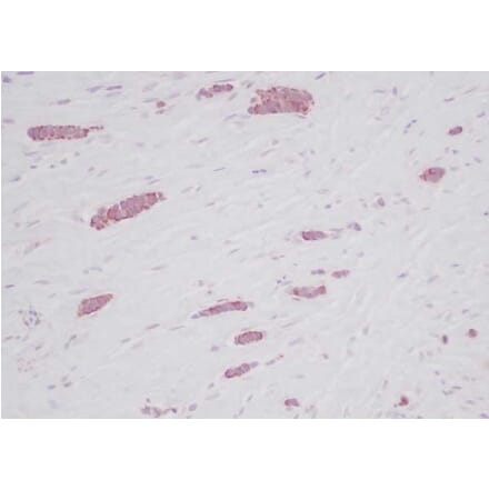 Immunohistochemistry - Anti-RANTES Antibody - BSA and Azide free (A283833) - Antibodies.com
