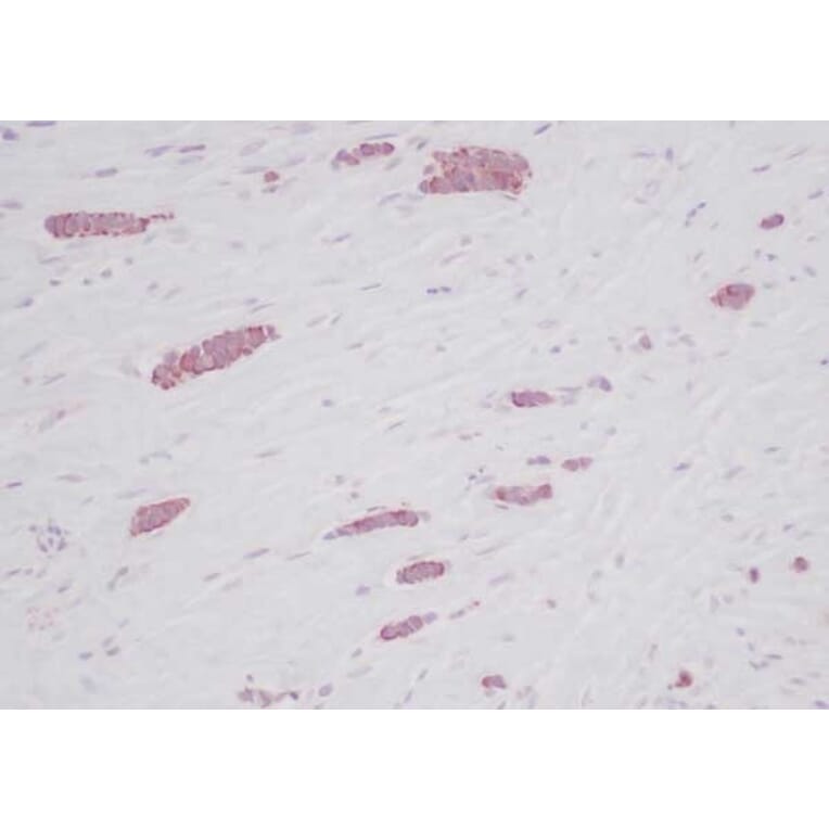 Immunohistochemistry - Anti-RANTES Antibody - BSA and Azide free (A283833) - Antibodies.com