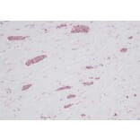 Immunohistochemistry - Anti-RANTES Antibody - BSA and Azide free (A283833) - Antibodies.com