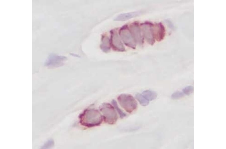 Immunohistochemistry - Anti-RANTES Antibody - BSA and Azide free (A283833) - Antibodies.com