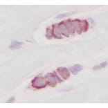 Immunohistochemistry - Anti-RANTES Antibody - BSA and Azide free (A283833) - Antibodies.com