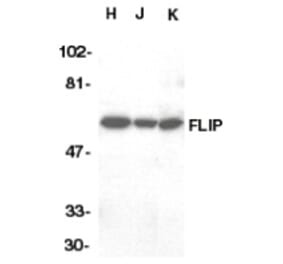 Western Blot - Anti-FLIP Antibody (A283850) - Antibodies.com
