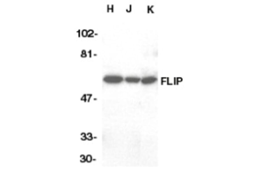 Western Blot - Anti-FLIP Antibody (A283850) - Antibodies.com