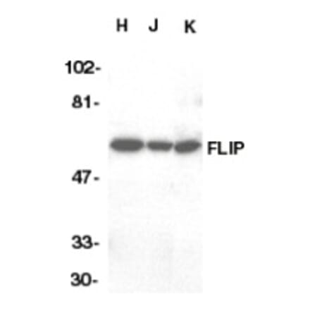 Western Blot - Anti-FLIP Antibody (A283850) - Antibodies.com