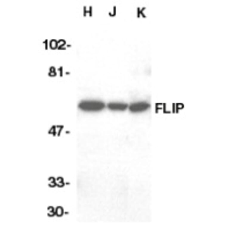 Western Blot - Anti-FLIP Antibody (A283850) - Antibodies.com