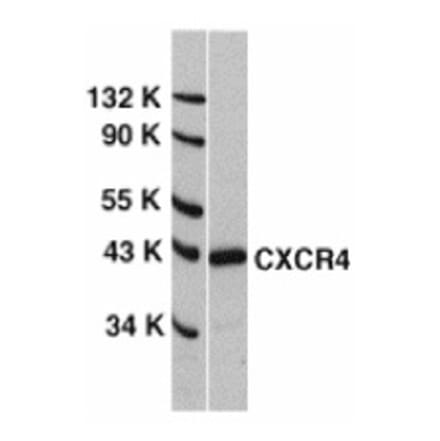 Western Blot - Anti-CXCR4 Antibody (A283856) - Antibodies.com