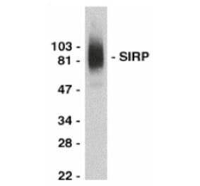 Western Blot - Anti-SIRP alpha Antibody (A283857) - Antibodies.com