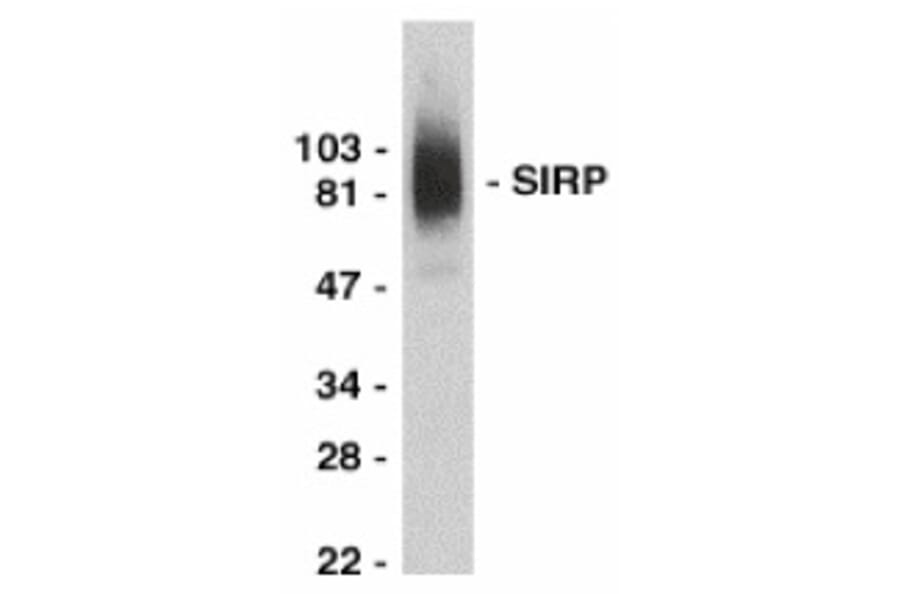 Western Blot - Anti-SIRP alpha Antibody (A283857) - Antibodies.com