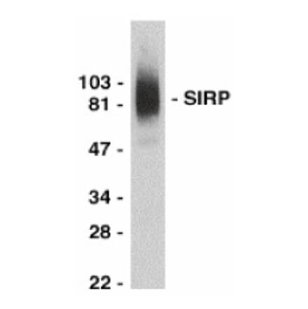 Western Blot - Anti-SIRP alpha Antibody (A283857) - Antibodies.com