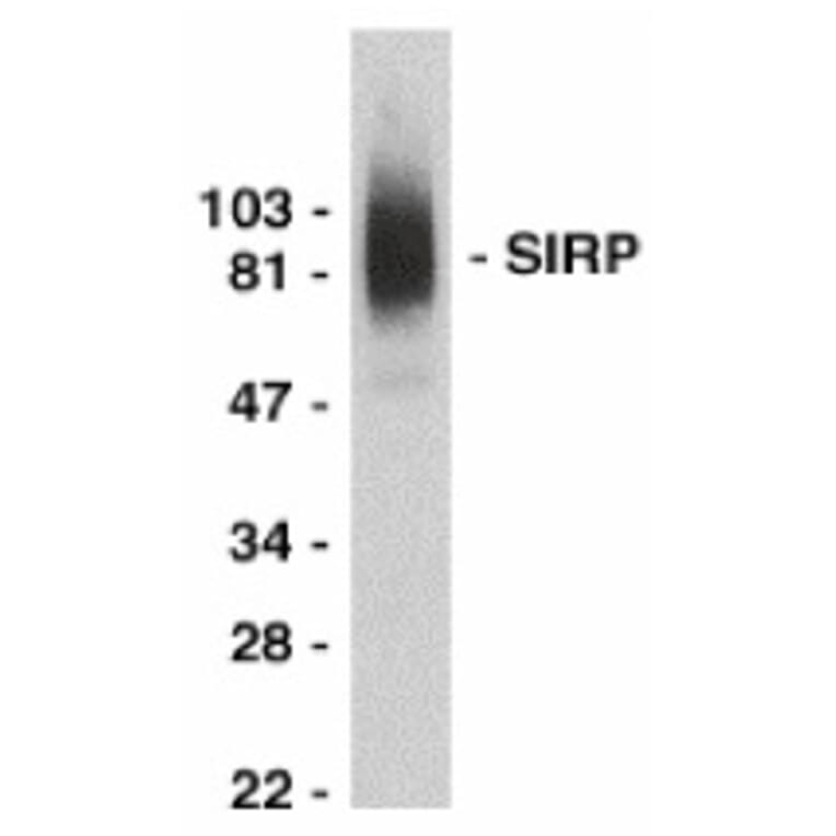 Western Blot - Anti-SIRP alpha Antibody (A283857) - Antibodies.com