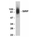 Western Blot - Anti-SIRP alpha Antibody (A283857) - Antibodies.com